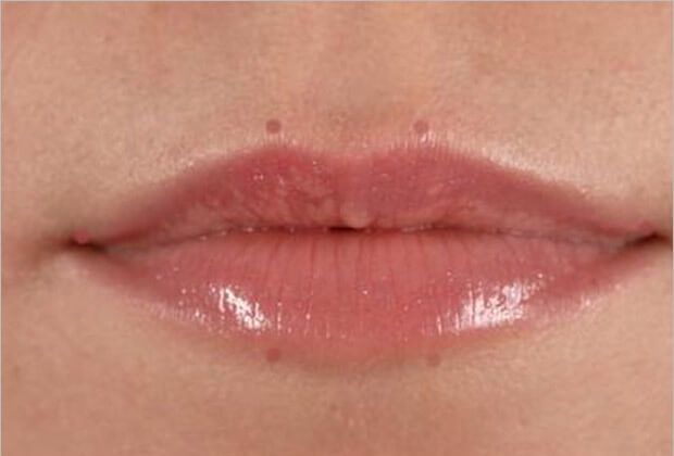 fuller-looking-lips