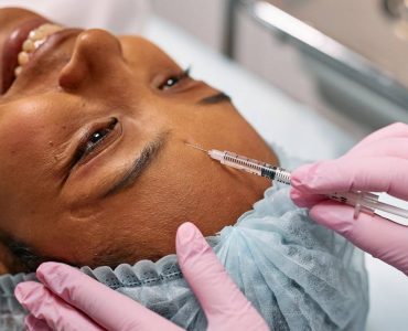 Exosomes With Microneedling