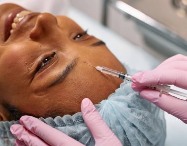 Exosomes With Microneedling